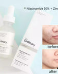 NIACINAMIDE 30ML